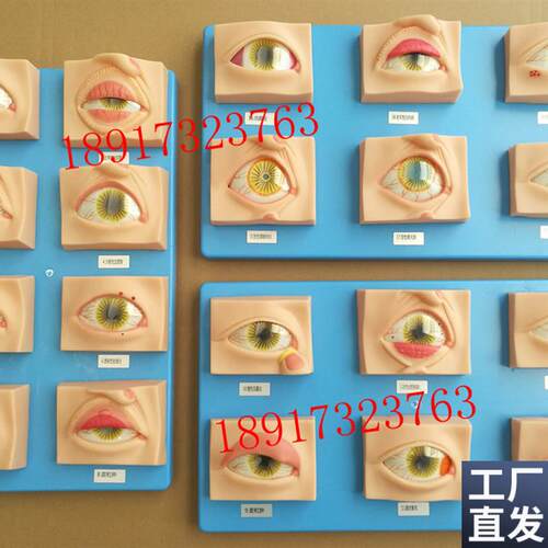 常见眼病模型20k种眼睛疾病模型眼科常见疾病模型眼球病变模型