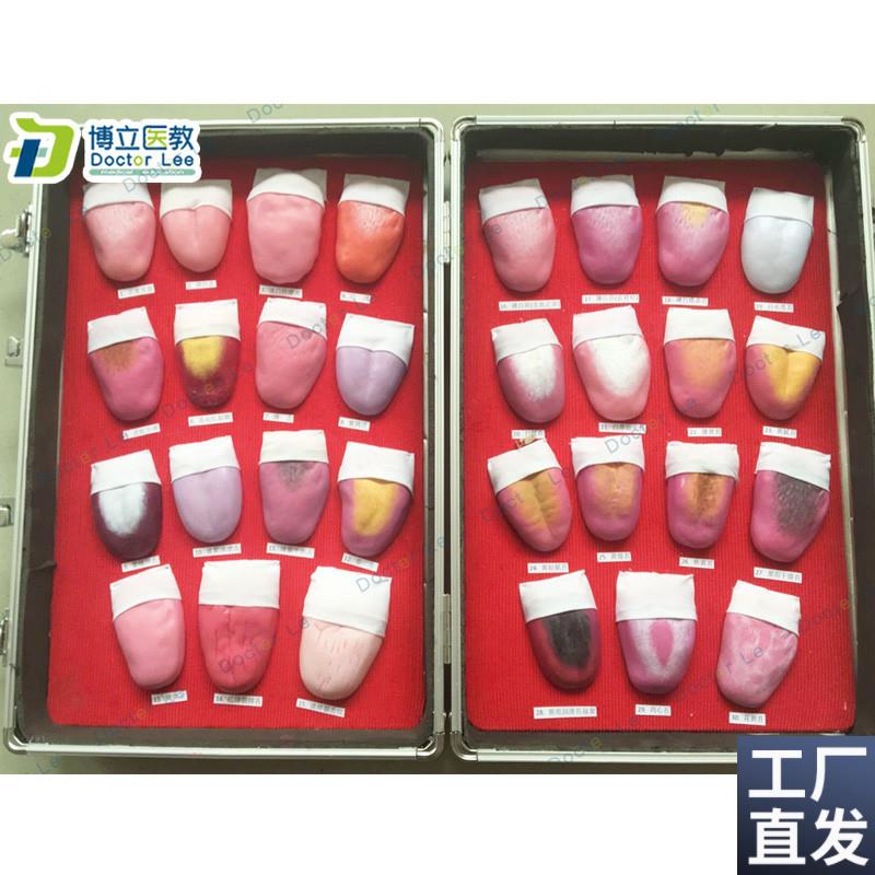 人体舌头舌苔常见病q变比较模型口腔护理医用教学人体模型
