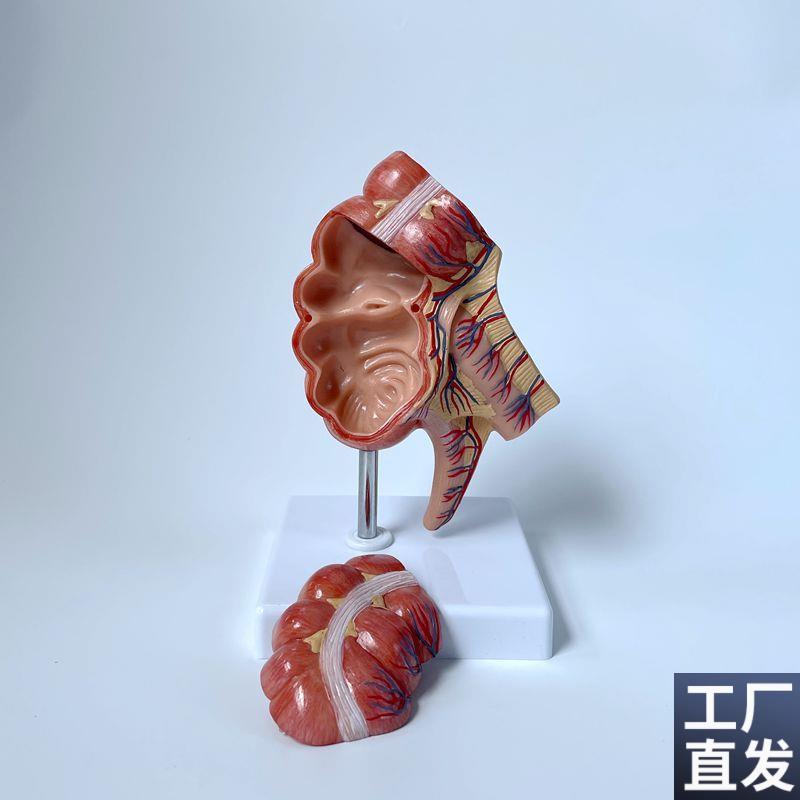 盲肠模型阑尾肠壁粘膜回r盲瓣肛肠科室摆件消化道医药促销医用教