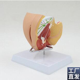 女生殖器解剖模型盆腔盆底泌尿膀胱会阴子宫肛管R直肠妇科医学教
