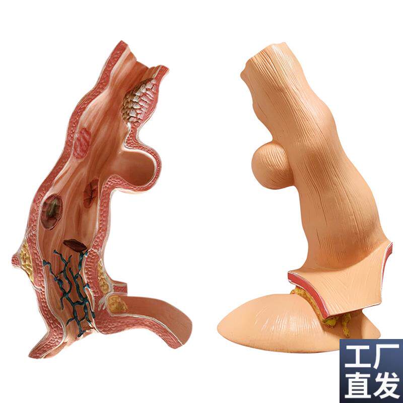 人体食管食道胃部k消化系统解剖模型解剖骨骼教学医学教具厂家包