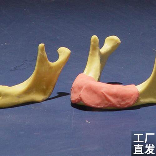 ENOVO颐诺下颌骨种植操u作模型口腔种植口腔齿科培训实训操作模