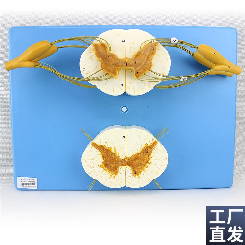 ENOVO颐诺医学人体脊髓脊神经分支模型周围神经系统X脊柱麻醉解剖