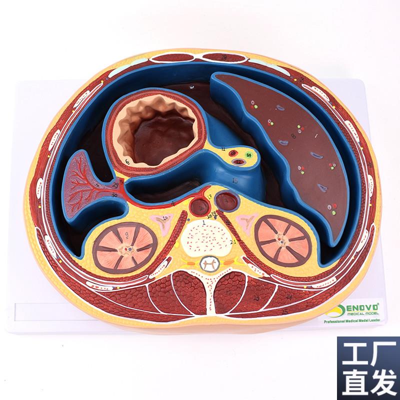 ENOVO颐诺j人体腹部断面模型平网膜网膜囊孔结构解剖标本