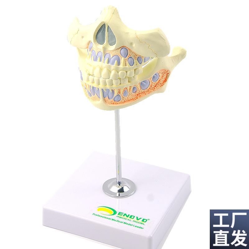 ENOVO颐诺乳牙牙列模型儿童口D腔齿科牙医培训教学医生教具乳牙