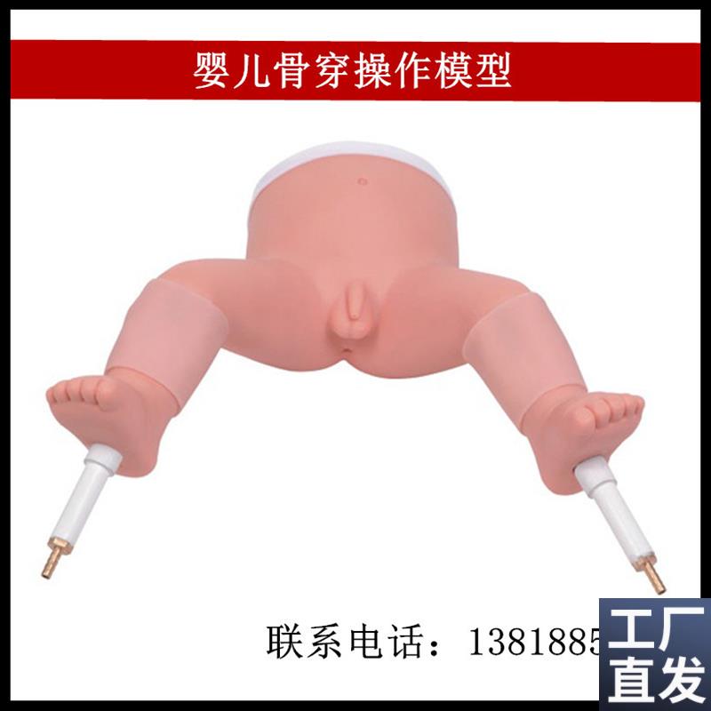 婴儿骨穿操作模型