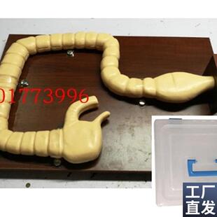 乙状结肠镜检查模型H大肠肠道病变模型