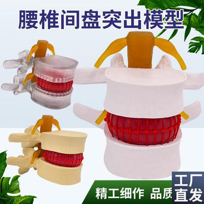 腰椎模型教学医学人体腰椎v间盘受压演示脊柱骨突出病理骨质教具