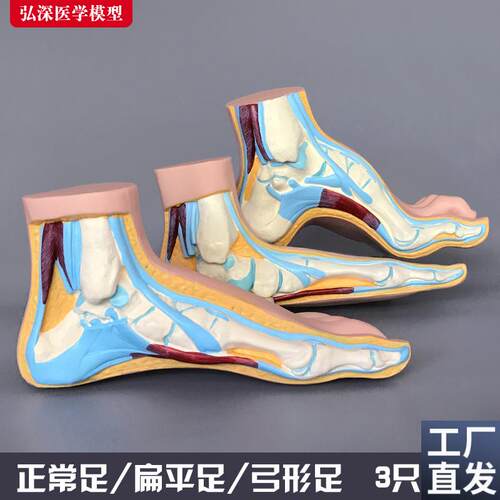 脚模型正常d足扁平足弓型足解剖人体脚部构结构造肌肉血管医学模