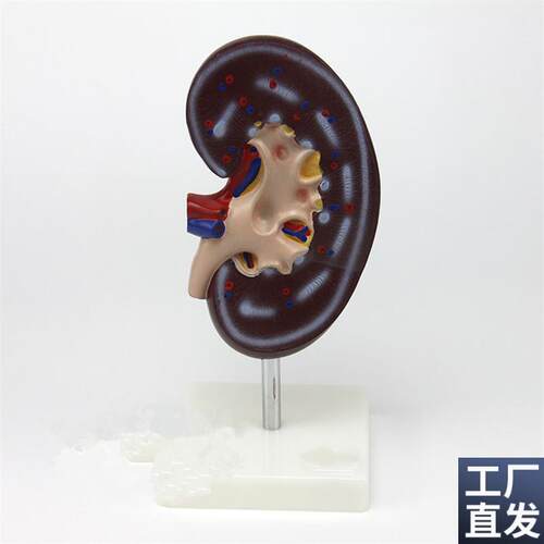 肾解剖模型1件