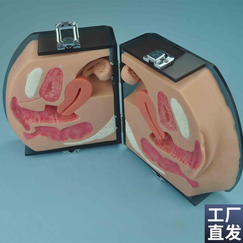 女性避孕指导模型