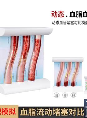 血管浓稠a度堵塞对比人体血脂斑块血栓展示模具仿真动态血管模型