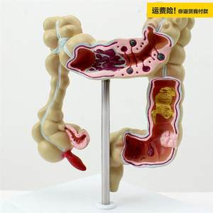 E.NOVO颐诺医学用人体结肠病变模型肛肠消化内科大肠模型医生礼