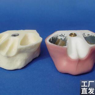 颐诺口腔牙科种植练习实训操作上颌骨带N上颌窦提升练习模型