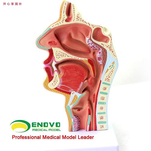 ENOVO颐诺人体鼻腔o咽喉疾病解剖模型鼻咽腔病理模型耳鼻喉科医