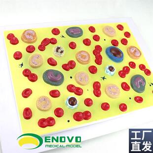 ENOVO颐诺医学人体血细胞放y大模型血液病学内科病理生理教学模型