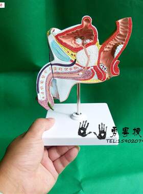 男性内生殖器病理模型病q变生殖解剖模型男泌尿系统疾病模型