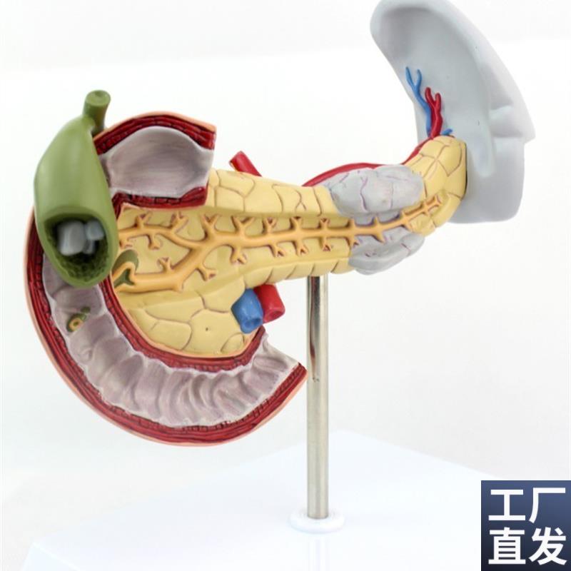 ENOVO颐诺医学用胰腺十二指肠和E胆囊病理模型消化系统消化科模型