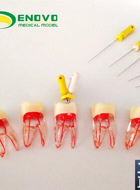 ENOVOd颐诺齿科根管离体牙根管治疗练习摸拟RCT根管教学练习牙体