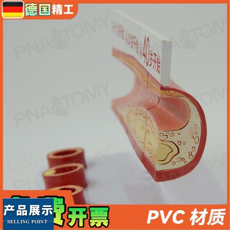 德国】人体血脂胆固醇与年龄模型 guan心病 血栓过程模  动脉医学