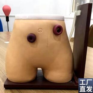 瘘管造口术护理模型s肠造口护理人医用教学讲解人体模型