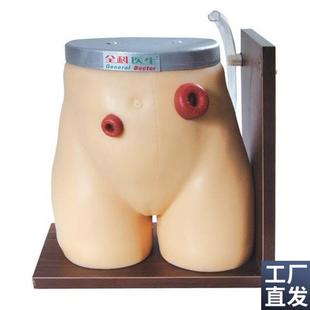 高级瘘管a造口术护理模型GD/H38