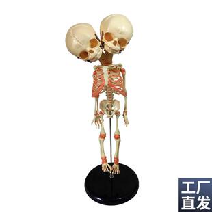 婴儿骷髅模型双头婴儿畸形骨骼骨架人骨素描K人体教学医用教仪35C