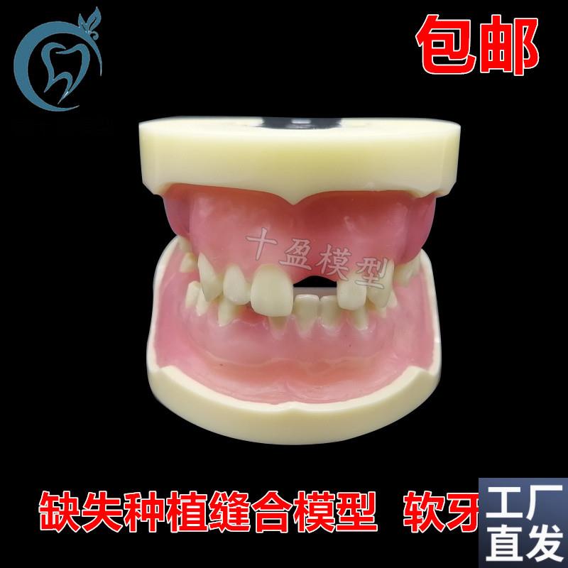 牙科缺失种植模型缝合练习牙模仿骨质G牙齿上颌窦提升术m2002