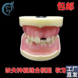牙科缺失种植模型缝合练习牙模仿骨质G牙齿上颌窦提升术m2002