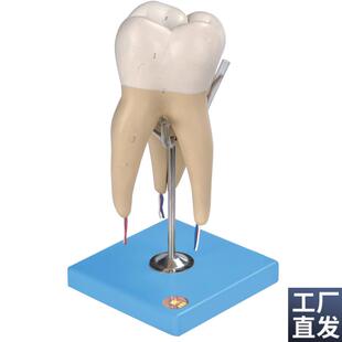 磨牙有三e个牙根模型B10004/5