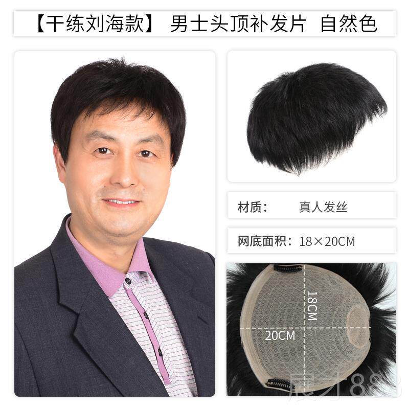 正品织发发补男士额补发前隐形无痕真人发发际补线秃顶发片补头顶