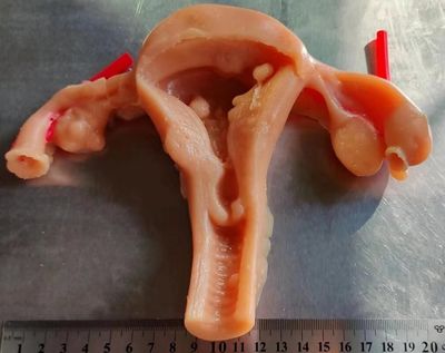 妇产科宫腔腹腔镜剪切缝合剥离模拟训练练习3D硅胶仿生模块模型