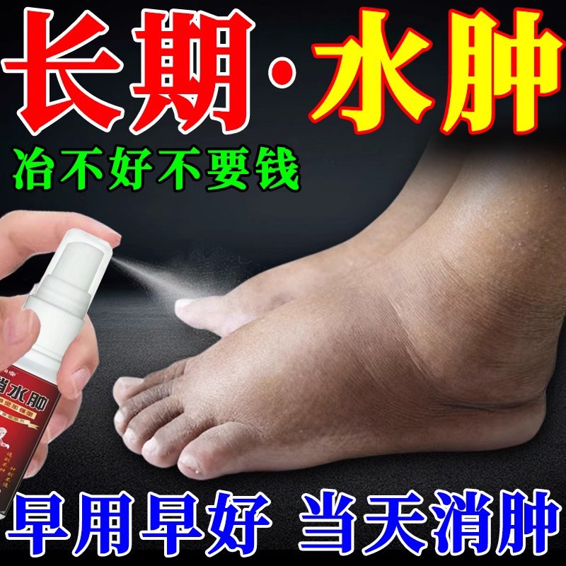 消肿去水肿专i用i治老i人脚肿利尿排水肿去下肢浮肿特i效贴喷剂