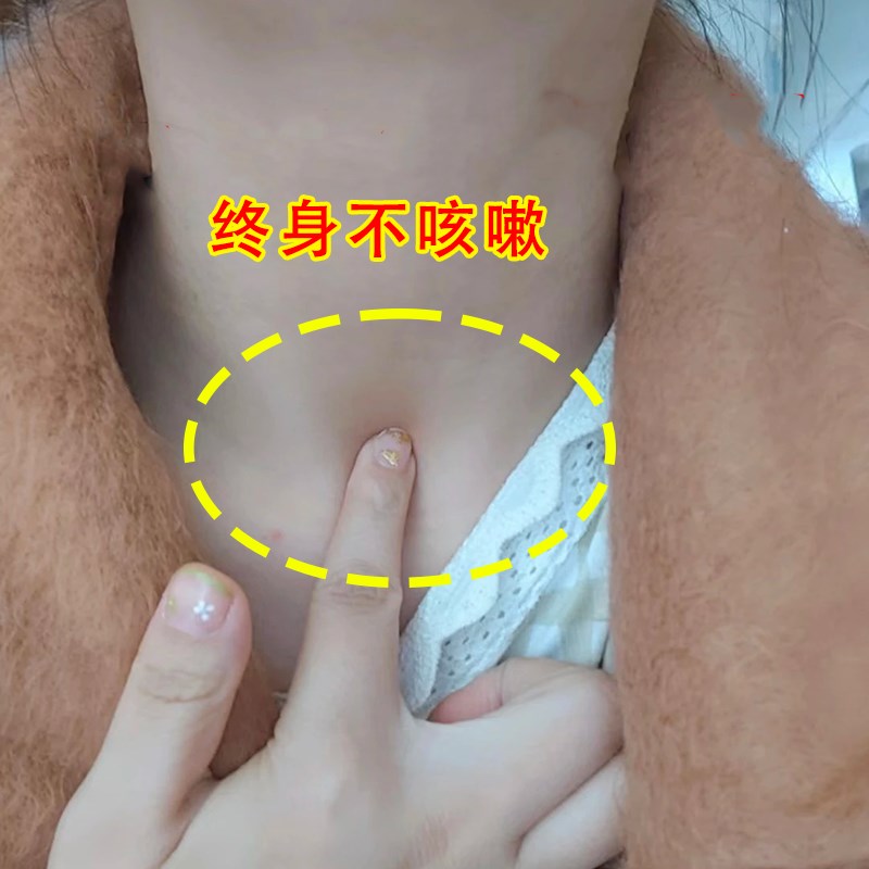【50倍止咳润肺】止咳贴特效咳嗽清肺化痰神器小儿成人平喘润肺JY