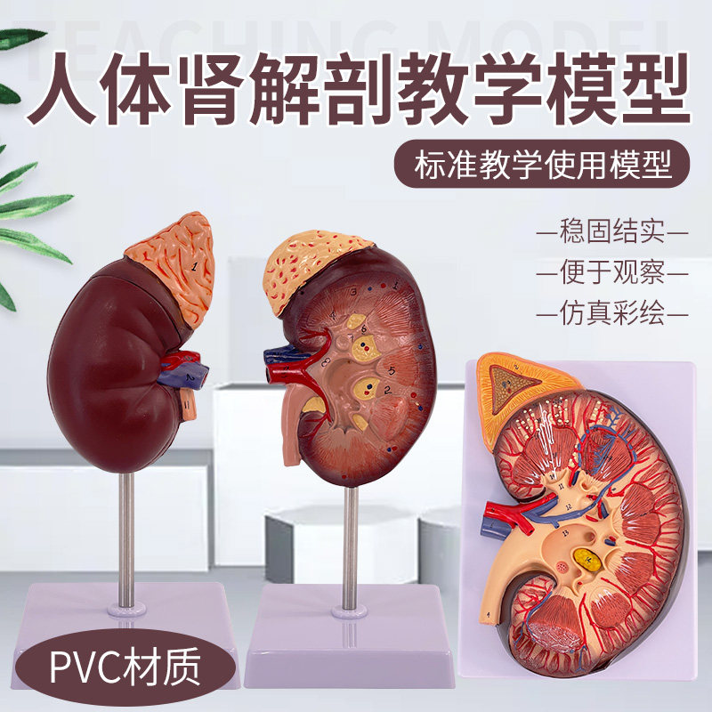 人体肾模型 肾解剖 自然大人体肾脏模型 肾脏演示 病变肾内脏模型