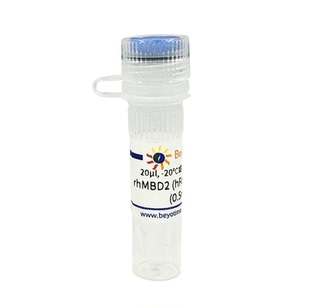 Recombinant Human MBD2 (hFc-Tag, HEK293) 碧云天 P2536