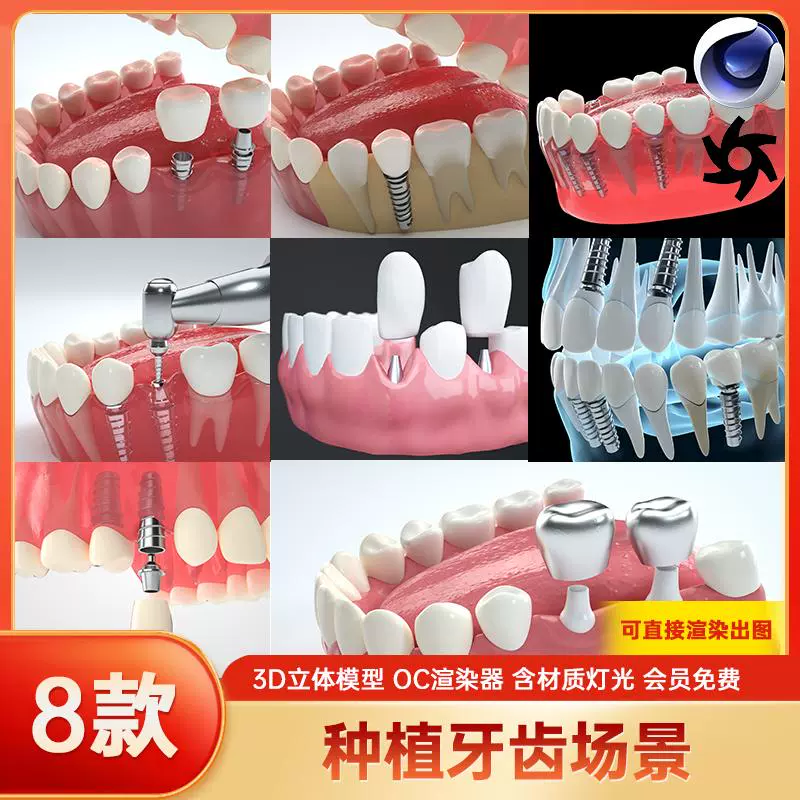 C4D模型素材口腔牙齿种植整形3D立体牙科医美医疗人体嘴巴OC渲染
