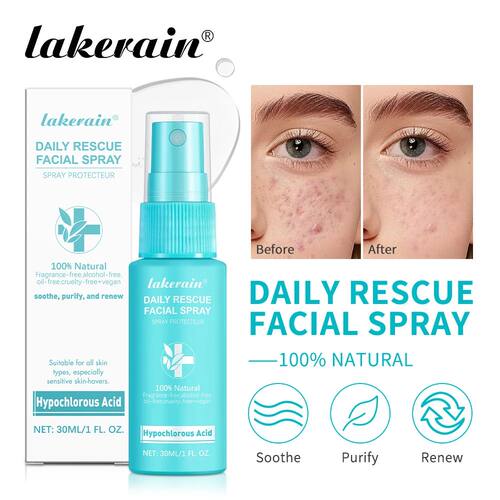 Calming Rescue Facial Spray For Sensitive Skin Hypochlorous
