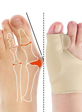 2Pcs=1Pair Toe Corrector Orthotics Feet Foot Care Bone
