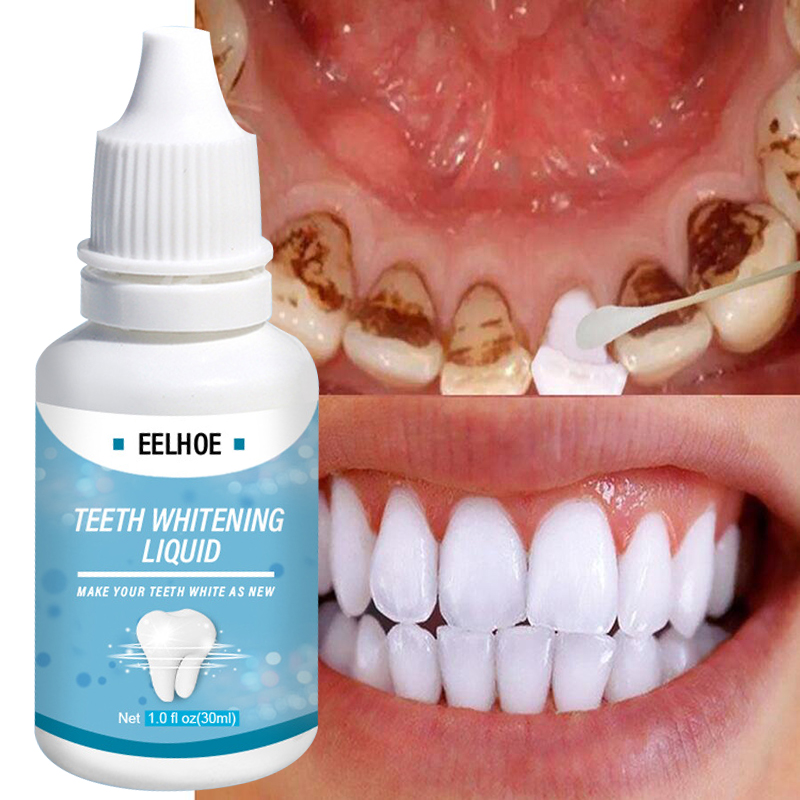 Teeth Whitening Essence Liqud Oral Hygiene Cleaning Whiten 彩妆/香水/美妆工具 化妆/美容工具 原图主图