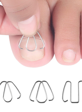 3Pairs Front nail hook/rubber band Nail Art Ingrown Toe Nail