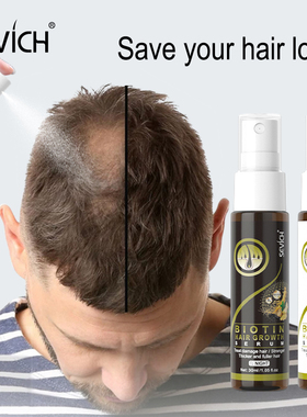 Biotin Hair Growth Spray Hair Growth Essential Oil