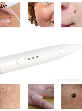 Beauty trument Laser Freckle Removal Machine Skin Mole