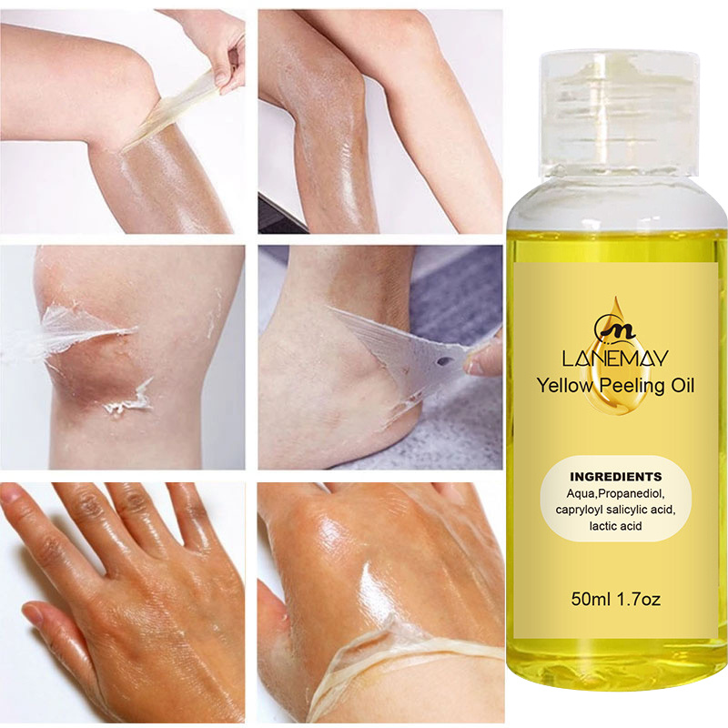 Yellow Peeling Oil Dark Skin Bleaching Remove Arm Knee Legs