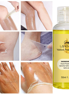 Yellow Peeling Oil Dark Skin Bleaching Remove Arm Knee Legs