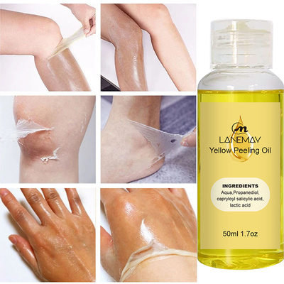 Yellow Peeling Oil Dark Skin Bleaching Remove Arm Knee Legs