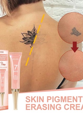 7 Days Permanent Tattoo Removal Cream Skin Tattoos Remover G