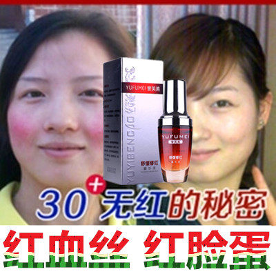 高原红精华液去红血丝舒缓正品面部淡化修复角质层红脸蛋过敏褪红