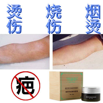 除去烧伤手术后增生性烟烫凹凸刀伤疤痕印修复液祛缝针色素灵正品
