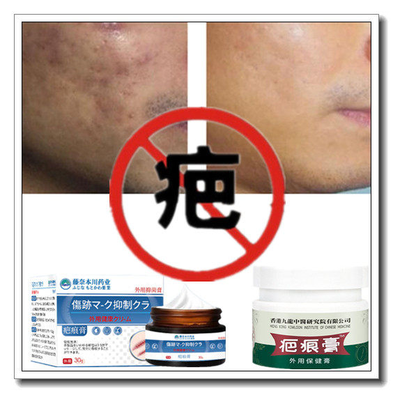 祛凸疙瘩软化增生性体质手术剖宫产伤疤痕印灵修复纹身沉着色素膏